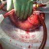 Human Liver For Sale